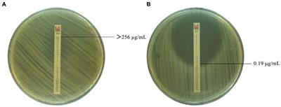 Molecular characterization and antimicrobial susceptibility of human Brucella in Northeast China